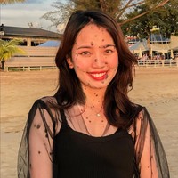 Semasa kecil Evita mengaku selalu merasa kesepian karena tidak ada yang ingin berteman dengannya. Padahal kondisinya itu bukanlah penyakit dan tidak menular.  Foto: Instagram/@evita_delmundo