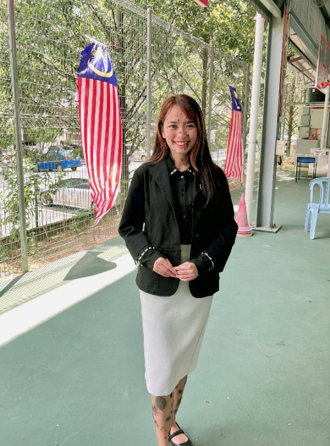 Sempat tidak percaya diri bertahun-tahun, Evita akhirnya belajar menerima tanda lahirnya dan mencintai diri sendiri. Di usia 20 tahun, dia mulai aktif mengikuti berbagai kompetisi, mulai dari lomba menyanyi hingga ikut kontes kecantikan. Pada 2018 dia memberanikan diri ikut audisi Miss Malaysia. Foto: Instagram/@evita_delmundo