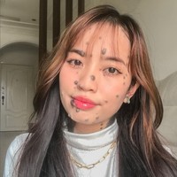 “Pertama, ini bukan penyakit. Mereka hanya tahi lalat normal. Saya telah bertemu dengan spesialis kulit dan mereka mengatakan kepada saya bahwa ini bukan penyakit kulit, ungkap Evita kepada New Straits Times. Foto: Instagram/@evita_delmundo