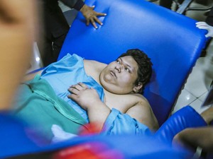 Fajri Bukan Satu-satunya, Ini Sederet Kasus Obesitas Ekstrem di Indonesia