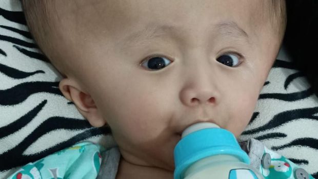 Bagas (3) divonis mengidap hidrosefalus saat usia janinnya menuju 9 bulan. Setelah lahir, ia harus menjalani operasi pemasangan selang. Yuk, kita bantu Bagas!