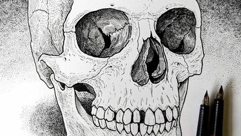 Dalam bahasa sehari-hari dikenal sebagai Bone Blisters. Mereka berongga, pertumbuhan seperti kulit telur yang terbentuk pada lapisan periosteum dan kortikol tulang. Tidak diketahui mengapa, tetapi mereka hanya mempengaruhi tengkorak. Ini adalah kondisi yang sangat langka - hanya kasus yang dicurigai di belahan bumi Barat yang ditemukan di beberapa kuburan tak bertanda di pemukiman Jamestown tahun 1607. Meskipun penyebabnya tidak diketahui, diyakini karena berkepanjangan konsumsi air minum dengan kadar tanin tinggi, diet kaya purin dan kekurangan kalsium. Selama Abad Pertengahan, para dokter percaya bahwa mengumpulkan pengetahuan seumur hidup akan menyebabkan deformasi tengkorak ini - kondisi ini hanya muncul pada orang tua. JFoto: Ed Harrington