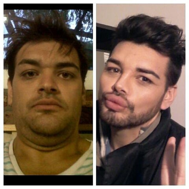 Dalam wawancara terbaru, Fran Mariano mengaku sudah menjalani lebih dari 40 kali perawatan agar wajahnya mirip dengan Ricky Martin. Foto: Instagram Fran Mariano