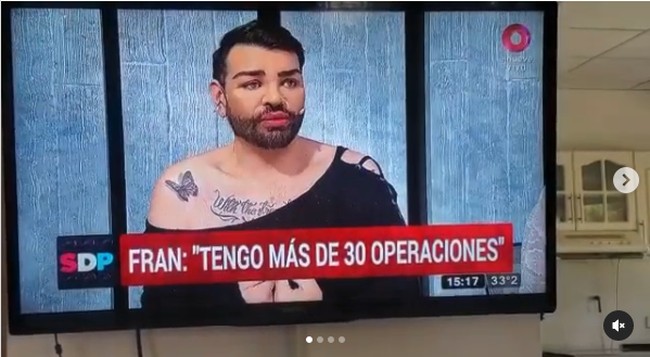 Begini penampilannya di televisi saat mengisahkan obsesinya mirip Ricky Martin. Foto: Instagram Fran Mariano