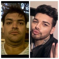 Dalam wawancara terbaru, Fran Mariano mengaku sudah menjalani lebih dari 40 kali perawatan agar wajahnya mirip dengan Ricky Martin. Foto: Instagram Fran Mariano