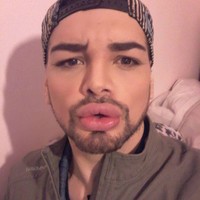 Aku tidak bisa merasakan setengah wajahku. Aku tidak bisa merasakan hidung, aku tidak merasakan daguku. Ketika aku meminum sampanye, aku harus melakukannya dengan bantuan serbet karena airnya tumpah (tidak tertelan semua), kata Fran, dilansir Semana.Foto: Instagram Fran Mariano