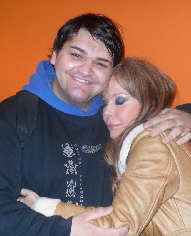 Begini wajahnya sebelum melakukan berbagai prosedur kecantikan.Foto: Instagram Fran Mariano