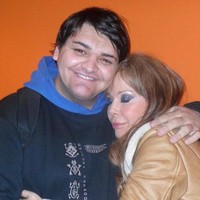 Begini wajahnya sebelum melakukan berbagai prosedur kecantikan.Foto: Instagram Fran Mariano