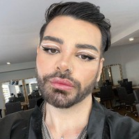 Mengakui bahwa tindakannya berlebihan, Fran kini memberikan petuah agar orang-orang tidak sembarang memodifikasi wajah. Dalam salah satu postingan, Fran Mariano mengaku tersiksa oleh efek samping dari berbagai prosedur yang dilakukan.Foto: Instagram Fran Mariano