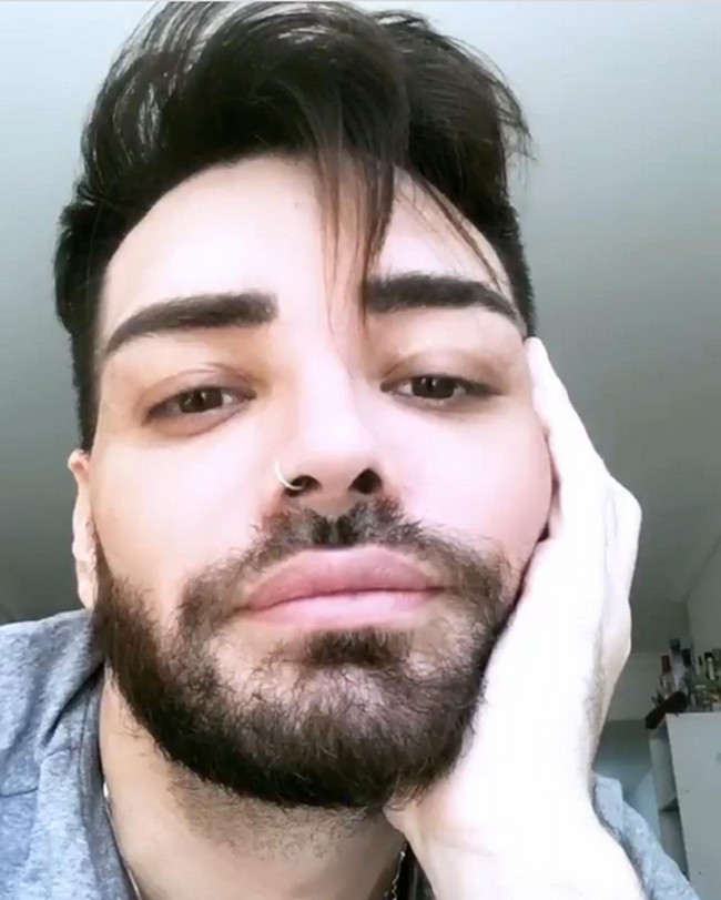 Fran Mariano telah melakukan berbagai prosedur kecantikan demi mirip Ricky Martin. Pria asal Argentina itu disebut terobsesi ingin tampil serupa bahkan jadi kloningan sang penyanyi sejak Ricky dinobatkan sebagai salah satu pria terseksi.Foto: Instagram Fran Mariano