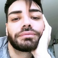 Fran Mariano telah melakukan berbagai prosedur kecantikan demi mirip Ricky Martin. Pria asal Argentina itu disebut terobsesi ingin tampil serupa bahkan jadi kloningan sang penyanyi sejak Ricky dinobatkan sebagai salah satu pria terseksi.Foto: Instagram Fran Mariano