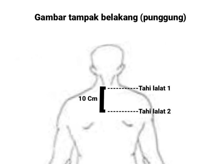 Mayat mutilasi Sidoarjo