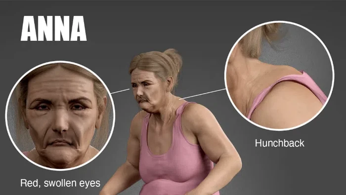 Riset Ungkap Gambar Mengerikan Postur Tubuh Pekerja WFH di Masa Depan