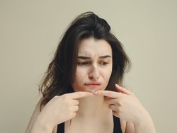 Jerawat Aktif Bikin Kesel? Coba 3 Rekomendasi Treatment ini di ZAP Clinic