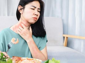 Barretts Esophagus