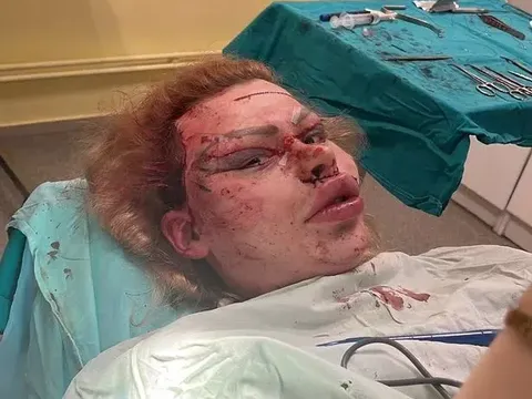 Patrick Mast Patrick Mast