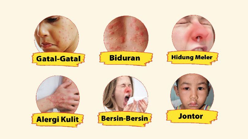 adv prosix adv prosix