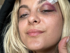 Kondisi Terkini Bebe Rexha Usai Ditimpuk HP oleh Fans Saat Konser