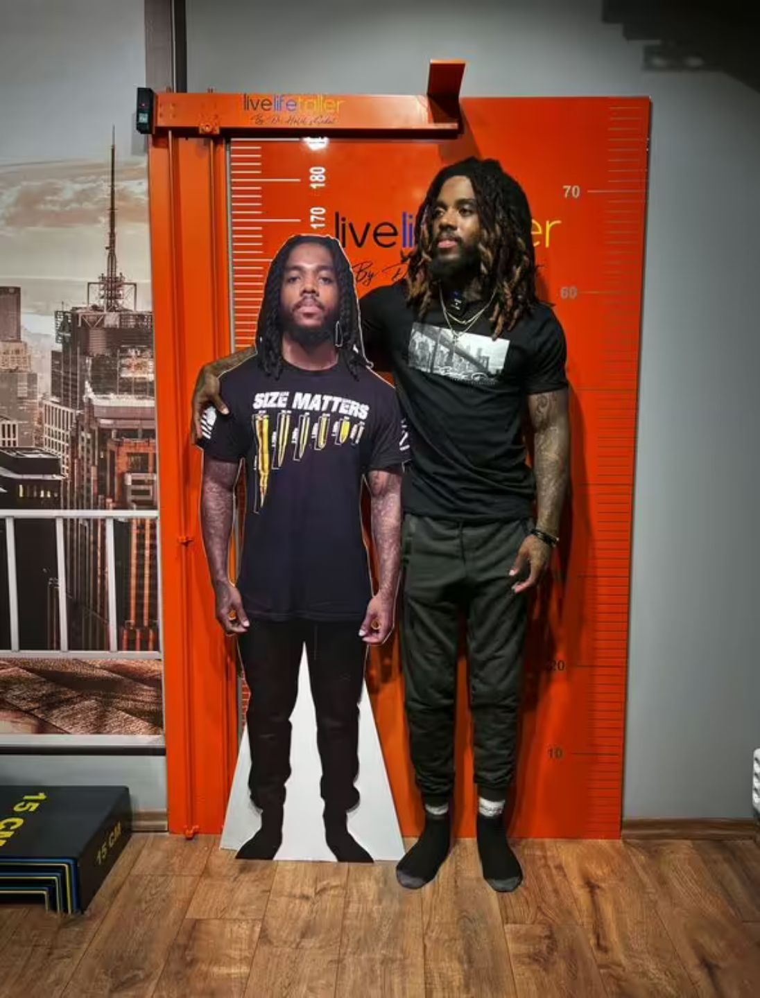 Dynzell Sigers Dynzell Sigers operasi pemanjangan kaki untuk jadi lebih tinggi.