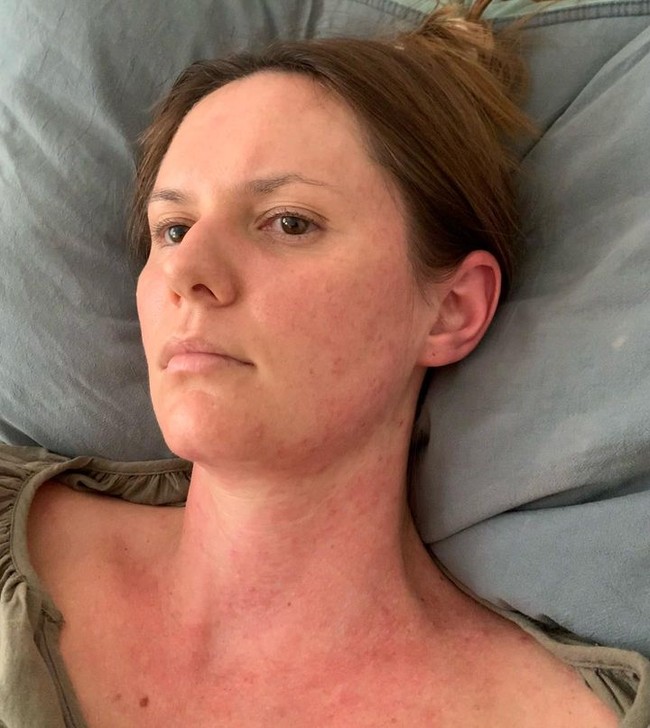 Dalam foto lain, wanita itu tampak lemas di tempat tidur rumah sakit. Dikatakan jika keadaan Jessica juga sering tidak sehat secara mental. Warna tubuhnya sering berubah-ubah yang diprediksi karena kondisi depresi.Foto: Instagram