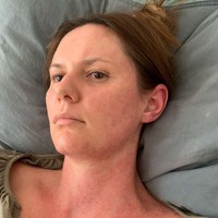 Dalam foto lain, wanita itu tampak lemas di tempat tidur rumah sakit. Dikatakan jika keadaan Jessica juga sering tidak sehat secara mental. Warna tubuhnya sering berubah-ubah yang diprediksi karena kondisi depresi.Foto: Instagram