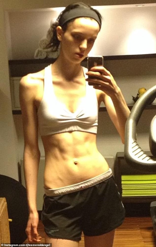 Diakui Esmeralda, lingkungan model cenderung toxic. Dia bahkan pernah sekurus ini saat menjadi model dulu. Foto: dok. Instagram