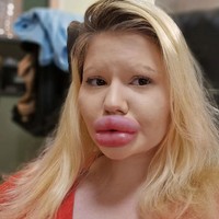 Wanita 25 tahun itu telah melakukan 43 kali prosedur pembesaran bibir, termasuk filler. Semakin besar semakin membuatnya percaya diri. Foto: dok. Instagram/@andrea88476