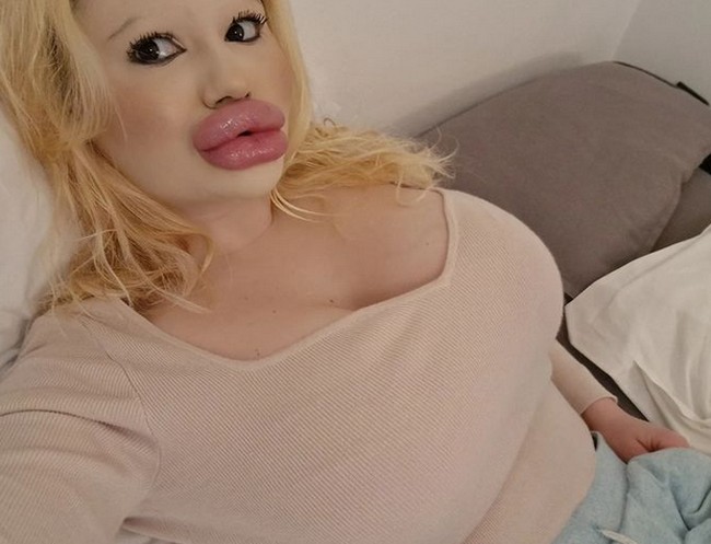 “Aku ingin melihat diriku dengan tampilan sebelum dan sesudah yang drastis, dan aku masih ingin punya banyak perubahan di depan,” tamhahnya. Foto: dok. Instagram/@andrea88476