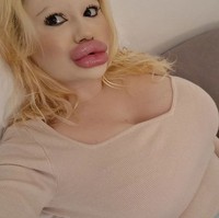 “Aku ingin melihat diriku dengan tampilan sebelum dan sesudah yang drastis, dan aku masih ingin punya banyak perubahan di depan,” tamhahnya. Foto: dok. Instagram/@andrea88476