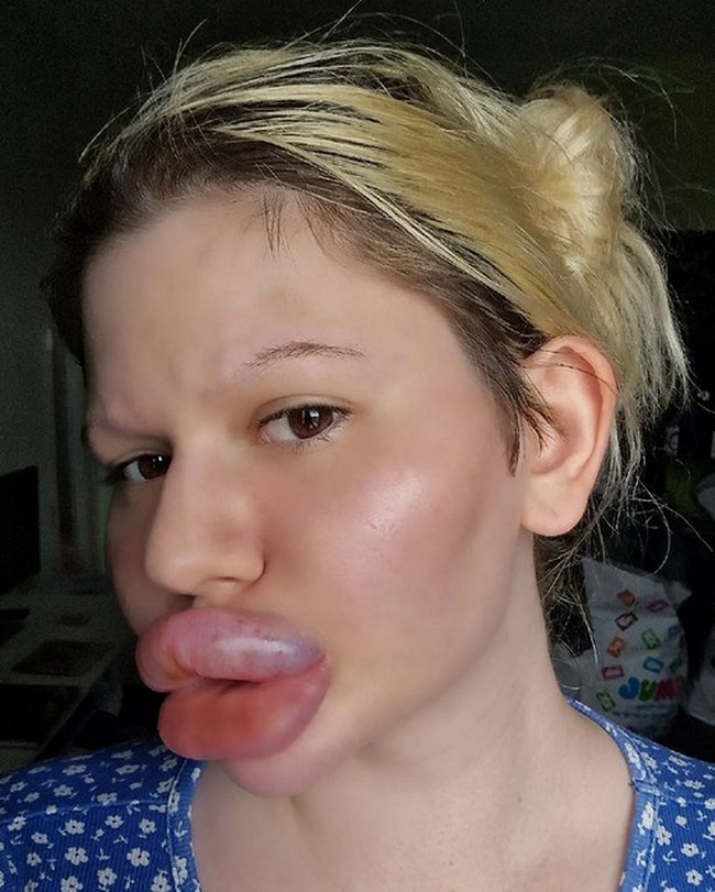 Andrea Ivanova, wanita asal Bulgaria dengan penampilan esktrem. Bibir besarnya itu hasil dari filler. Foto: dok. Instagram/@andrea88476