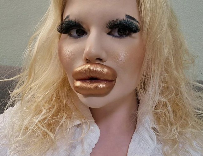 Andrea pun bangga menyebut dirinya pemilik bibir terbesar di dunia. Beginilah penampilan bibirnya yang tidak proporsional. Foto: dok. Instagram/@andrea88476