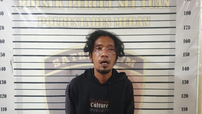 Ferdi (34) penarik becak yang babak belur saat di kantor polisi. (Foto: Dok. Polsek Percut Sei Tuan)
