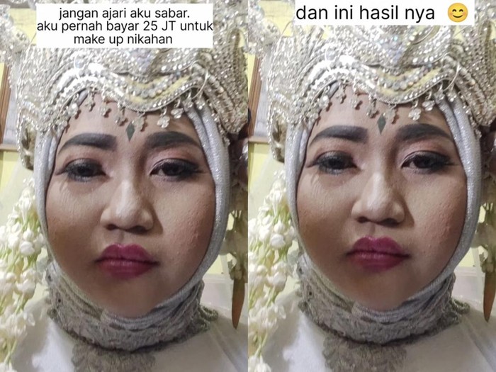 Wanita ini membagikan beberapa foto hasil makeup Rp 25 juta yang sudah ia bayar, ketika hari H pernikahan. Dia kecewa dengan hasil makeupnya yang tidak sesuai dengan ekspetasi.