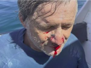 Surfing di Mentawai, Hidung Turis Aussie Tertusuk Garfish