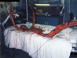 Foto Bersejarah Legendaris dengan Kisah Mengerikan