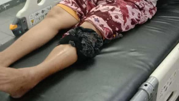 Warga Semampir Surabaya digigit ular sanca yang terinjak saat mau buang sampah.
