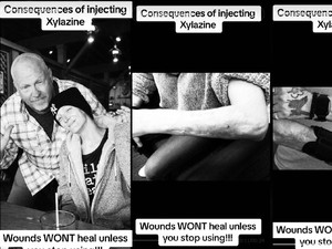 Geger Wanita Nekat Potong Kulitnya Sendiri, Busuk gegara Kecanduan Narkoba Zombie