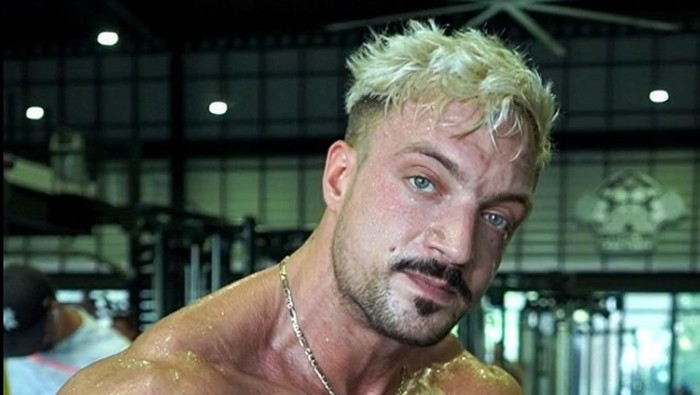 Apa Itu Aneurisma? Pemicu Binaragawan Jo Lindner Meninggal di Usia 30