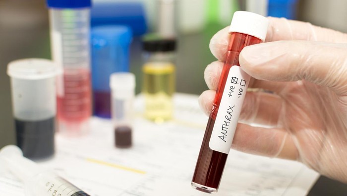 Holding a test tube with blood in it. Handwritten label with Anthrax on it with the positive tick box crossed.