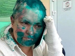 Jurnalis Investigasi Rusia Diserang di Chechnya, Diikat-Ditodong Pistol