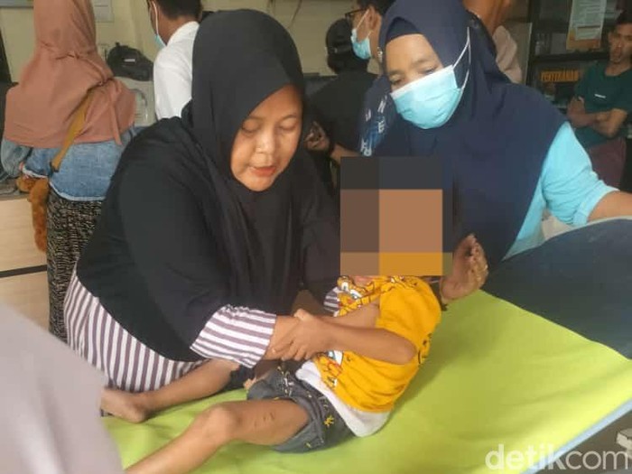 Bocah di Bangkalan digigit monyet liar