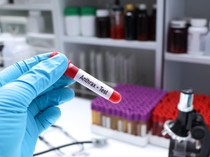 4 Warga Gunungkidul Positif Antraks Usai Makan Bangkai Kambing