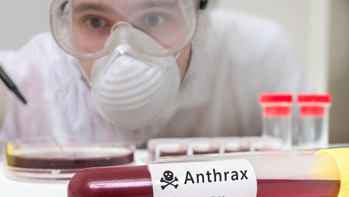 Scientist is analyting blood sample for Anthrax.