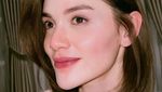 5 Potret Penampilan Hilda Vitria yang Kini Kurus