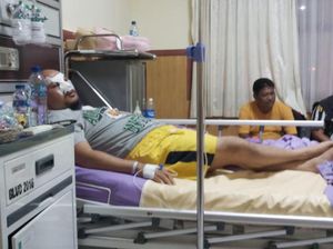 Duduk Perkara Adu Jotos Dua Kader Golkar hingga Wajah Bonyok