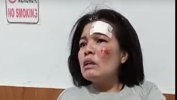 Pegawai Kodam I/BB Irawati Manurung yang jadi korban pembegalan. (Foto: Istimewa)