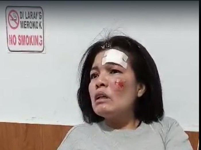 Pegawai Kodam I/BB Irawati Manurung yang jadi korban pembegalan. (Foto: Istimewa)