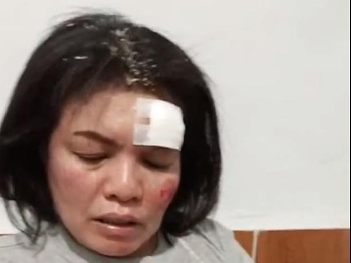 PNS Kodam I/BB Irawati Manurung yang menjadi korban begal. (Foto: Istimewa)