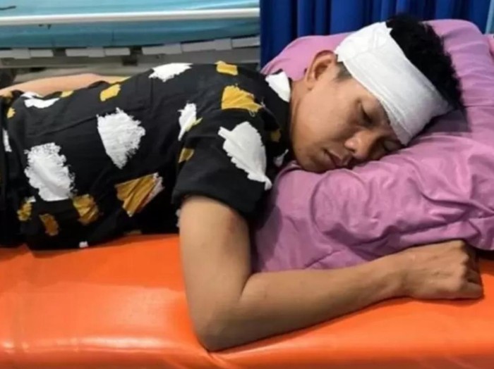 Seorang anggota polisi pecah kepala usai diserang warga saat patroli