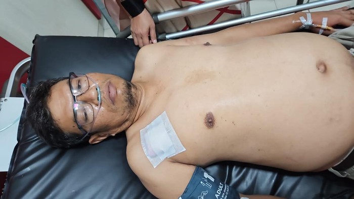 Wirman, pedagang yang jadi korban perampokan di Bukittinggi (Foto: Dok. Polresta Bukittinggi)